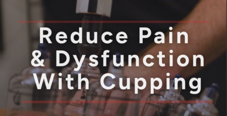 Not Just for Athletes: How Cupping Supports Everyday Recovery